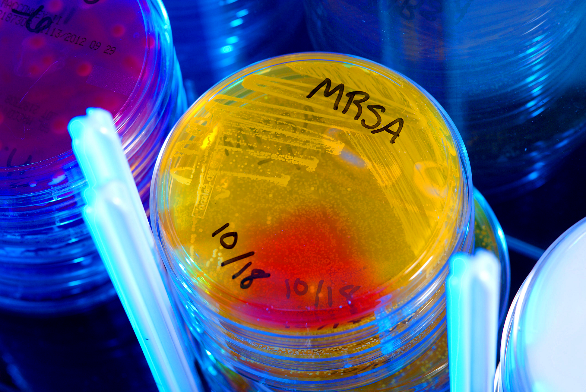 MRSA