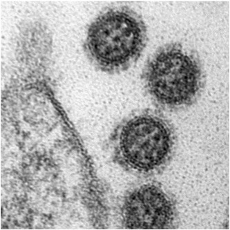 Influenza A Viruspartikel