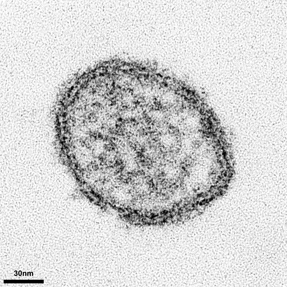 TULV_hantavirus Vero E6